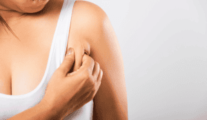 underarm fat